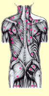 Trigger Points