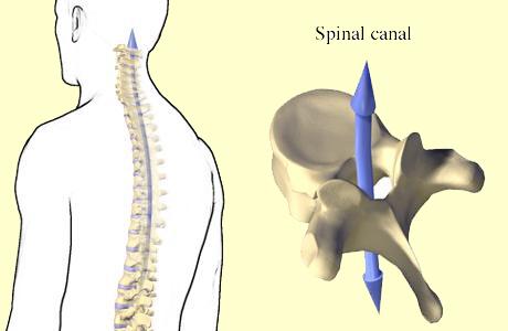 Neck pain is pain that occurs anywhere from the bottom of your head to the top of your shoulders. It may spread to the upper back or arms and may cause limited neck and head movement. 